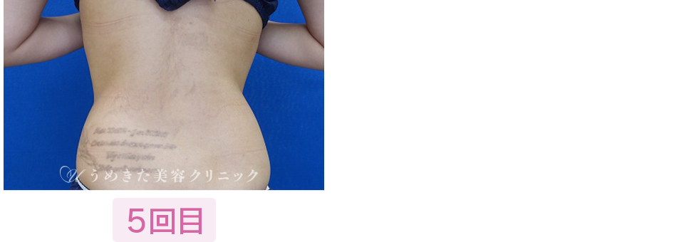5回目