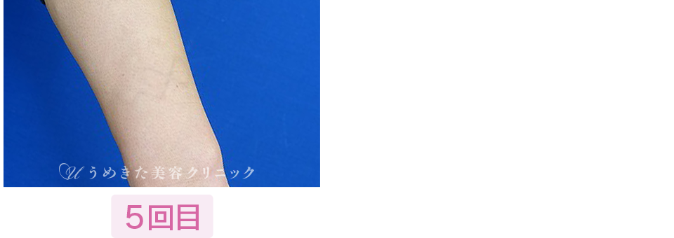 5回目